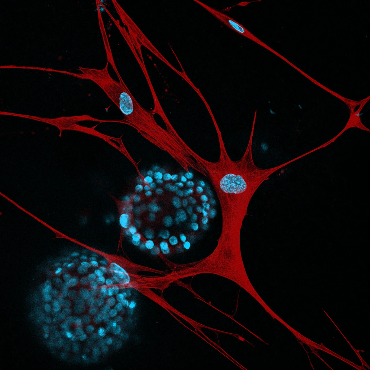 LHI-stoeger_iAT2-IPF-fibroblasts
