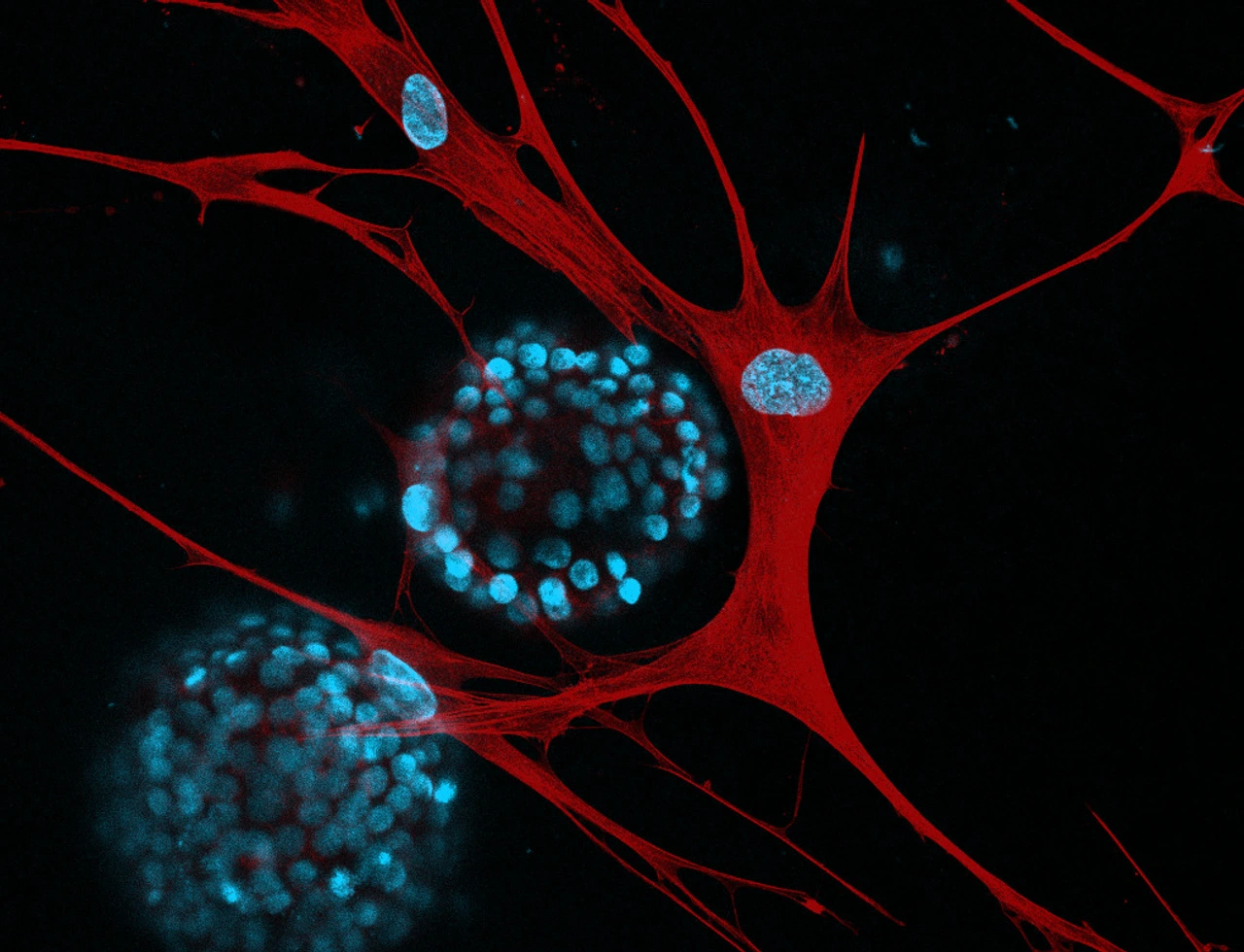 LHI-stoeger_iAT2-IPF-fibroblasts