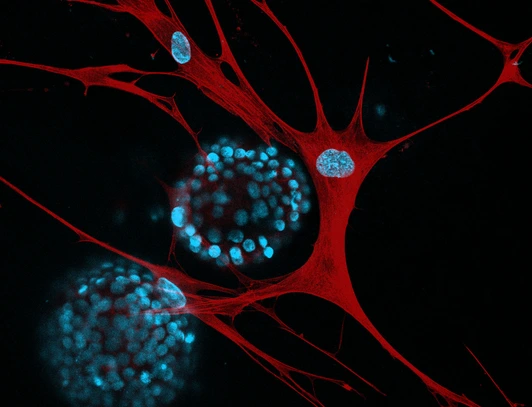 LHI-stoeger_iAT2-IPF-fibroblasts