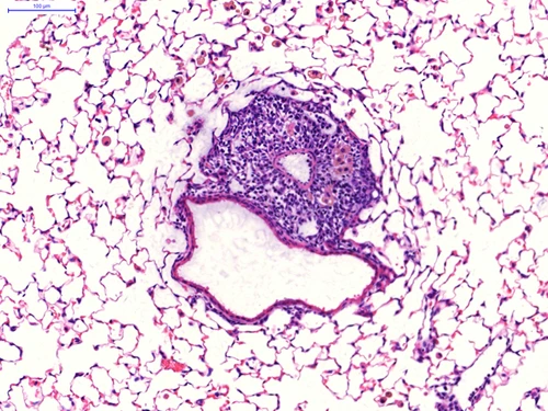 LHI-yildirim-iBALT_630x473px