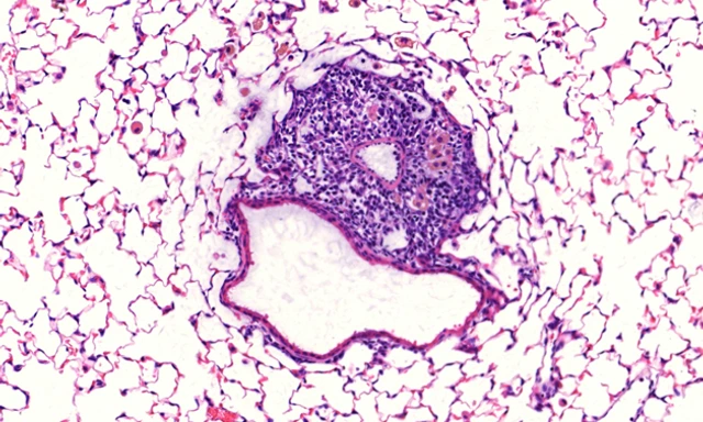 LHI-yildirim-iBALT_630x473px