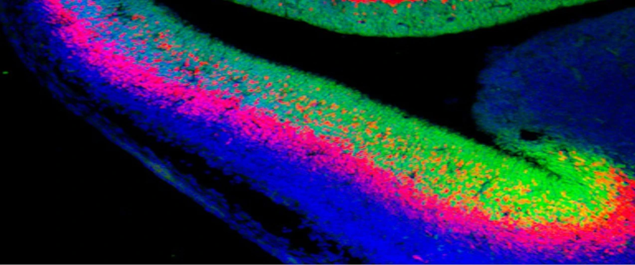 developed_brain_with_neural_stem_cells_in_green_2_isf