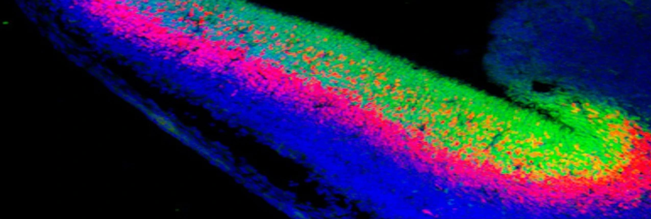 developed_brain_with_neural_stem_cells_in_green_2_isf