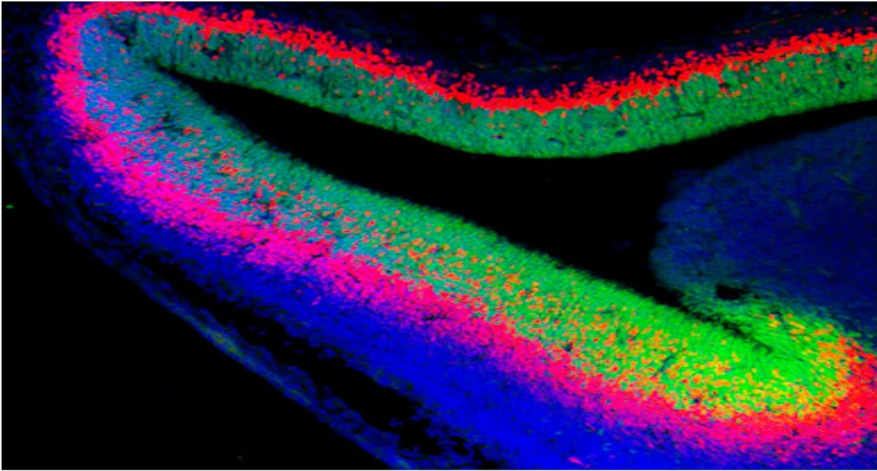 developed_brain_with_neural_stem_cells_in_green_2_isf
