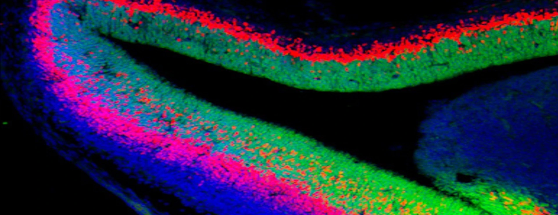 developed_brain_with_neural_stem_cells_in_green_2_isf