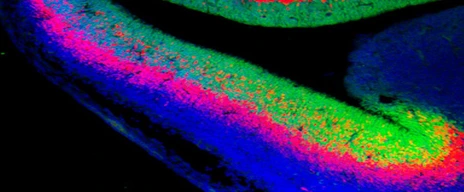 developed_brain_with_neural_stem_cells_in_green_2_isf