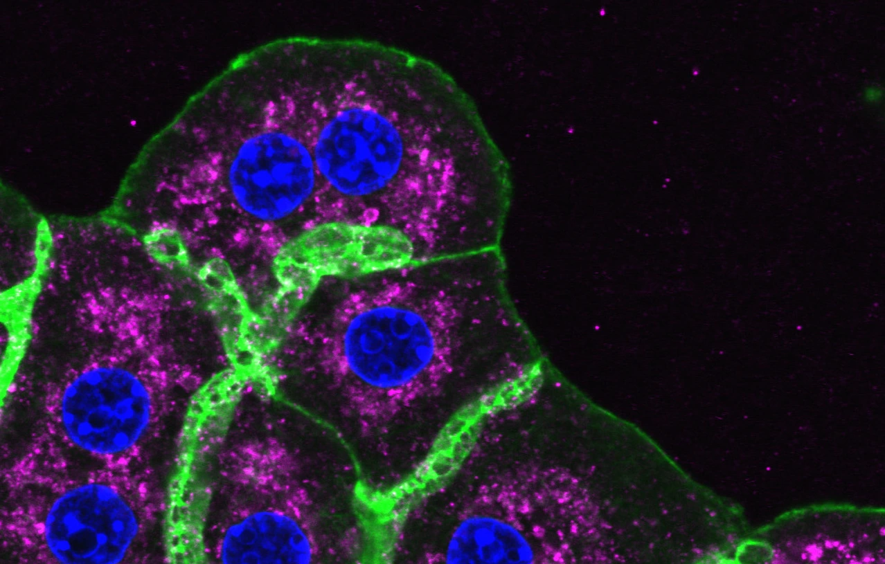 Mouse liver cells, Phall, DAPI, LAMP