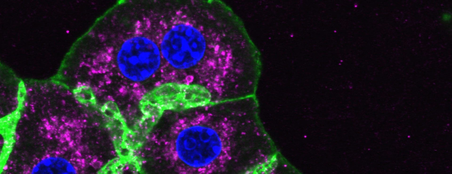 Mouse liver cells, Phall, DAPI, LAMP