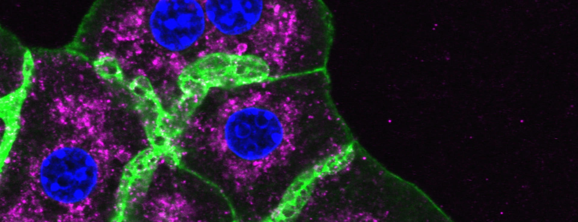 Mouse liver cells, Phall, DAPI, LAMP