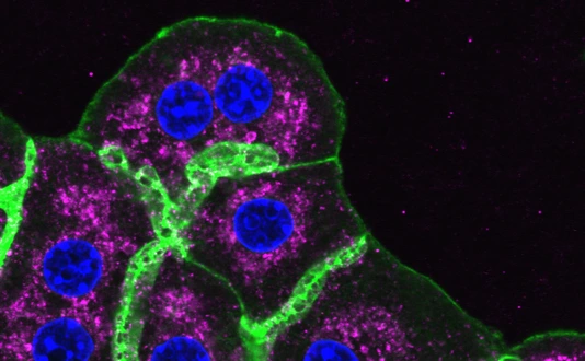 Mouse liver cells, Phall, DAPI, LAMP