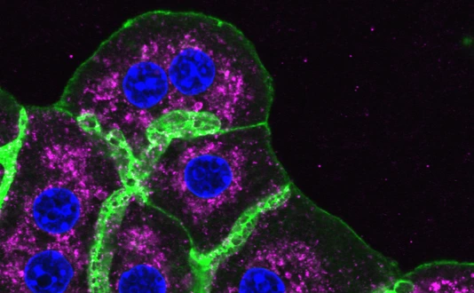 Mouse liver cells, Phall, DAPI, LAMP