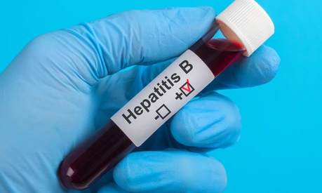 test vitro Hepatitis B HBV to the hand in glove on a blue background