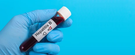 test vitro Hepatitis B HBV to the hand in glove on a blue background