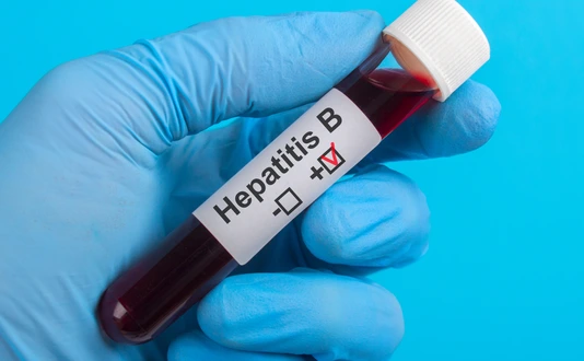 test vitro Hepatitis B HBV to the hand in glove on a blue background