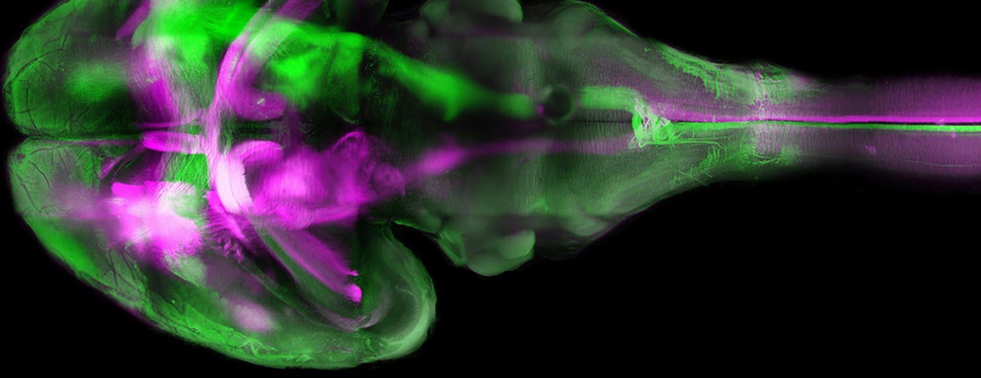 The brain of a mouse - fluorescence microscopy using "tissue clearing"