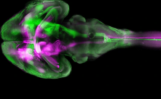 The brain of a mouse - fluorescence microscopy using "tissue clearing"