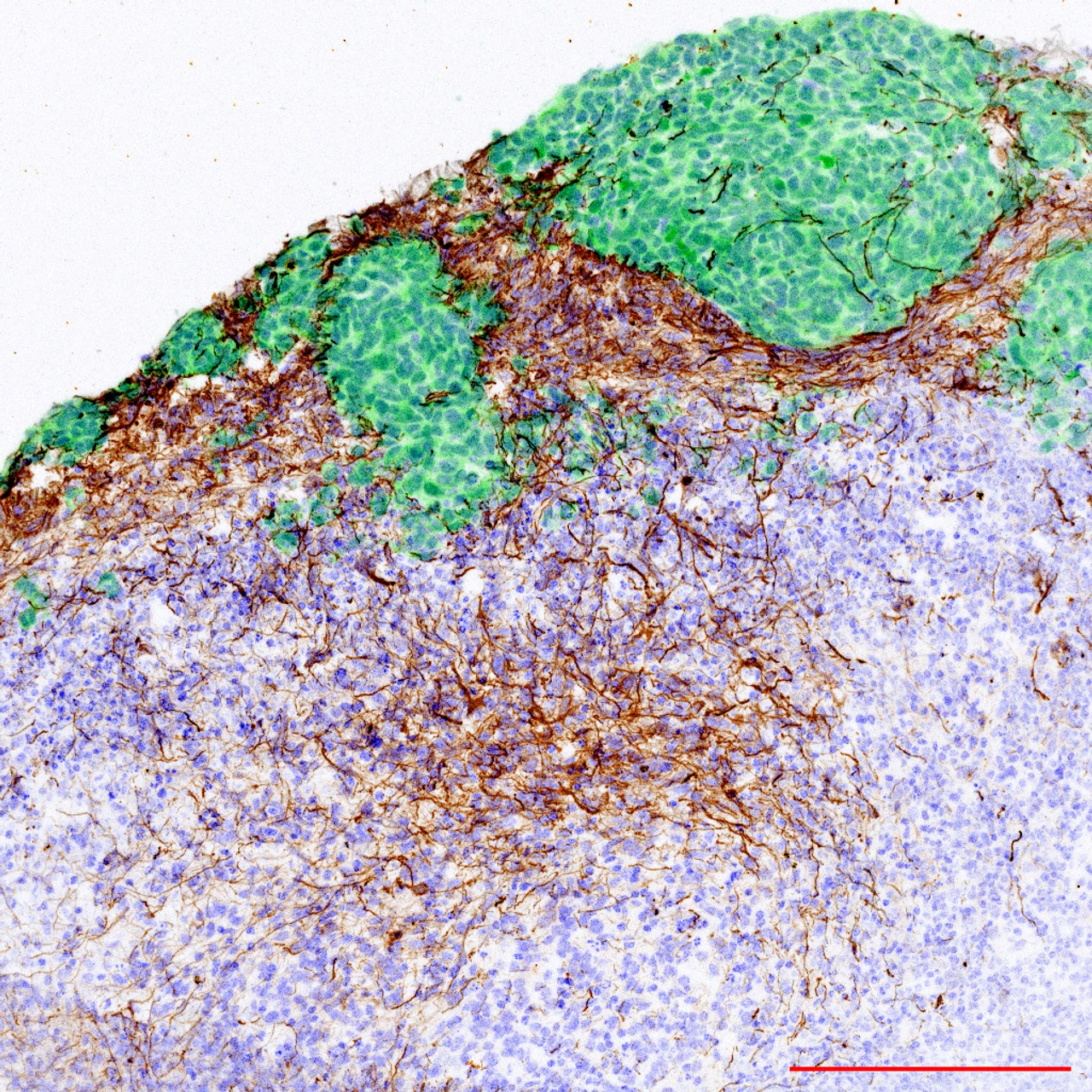 Glia hold the key to both brain damage and repair.