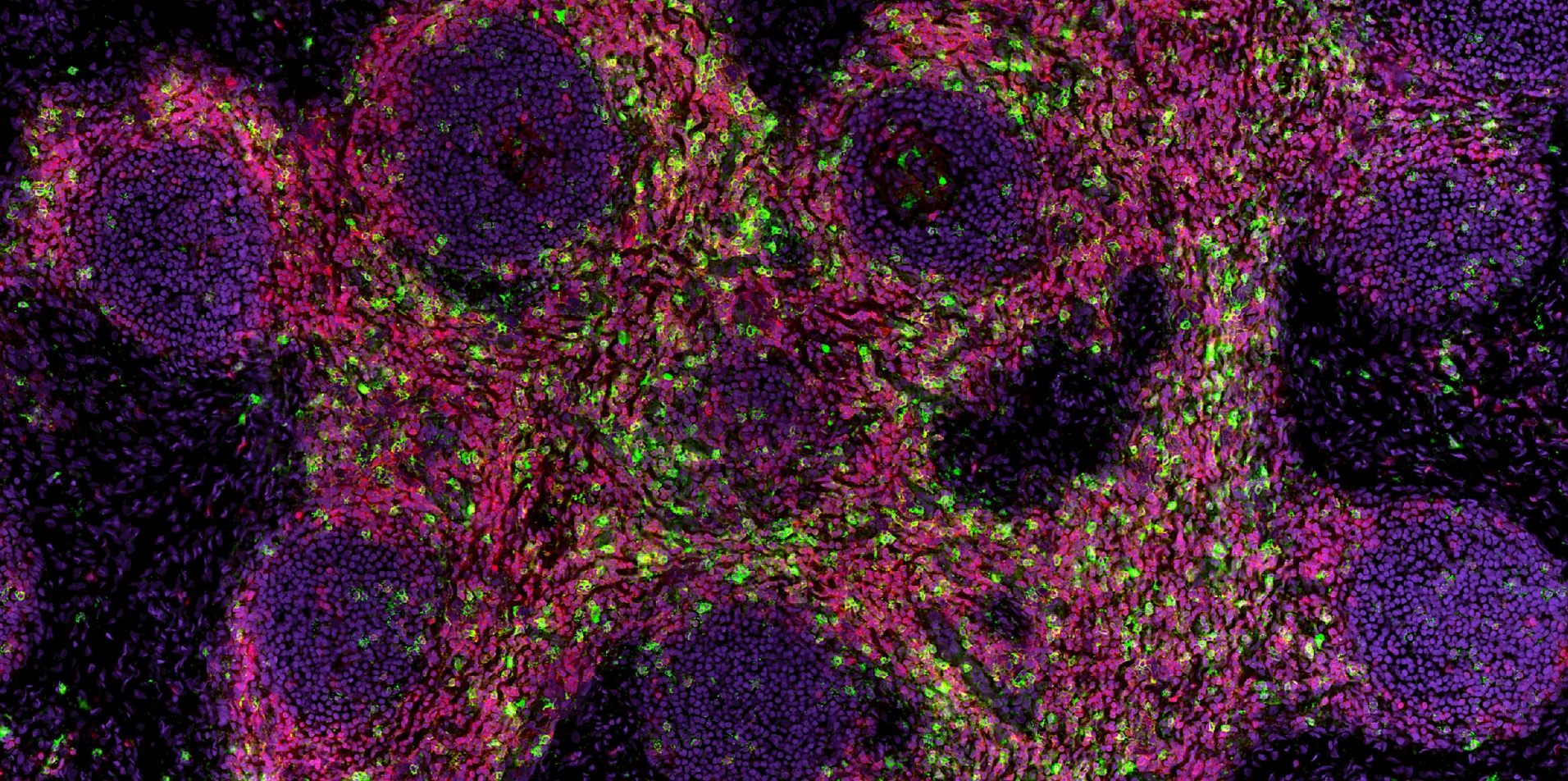 Rodriguez-Calvo_lymph_node