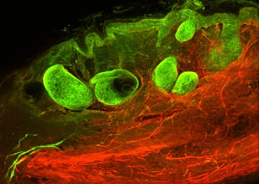 Wound healing_scarring process.Nature