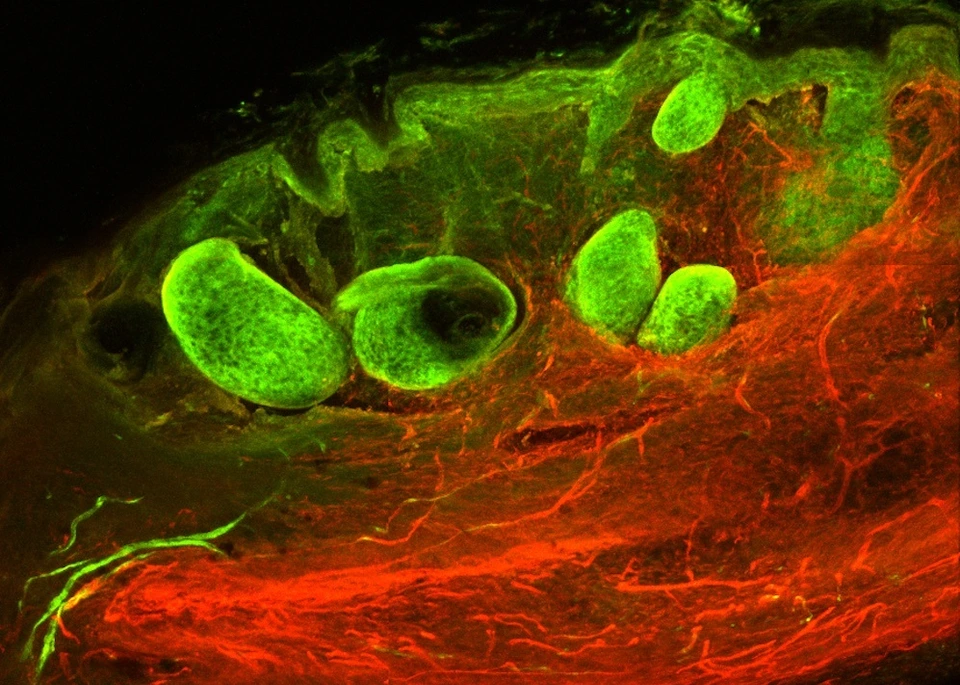 Wound healing_scarring process.Nature