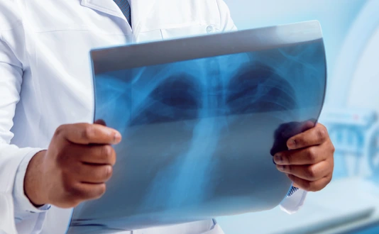 Doctor looking MRI picture.
