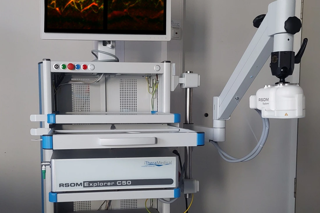 RSOM AI-Scanner