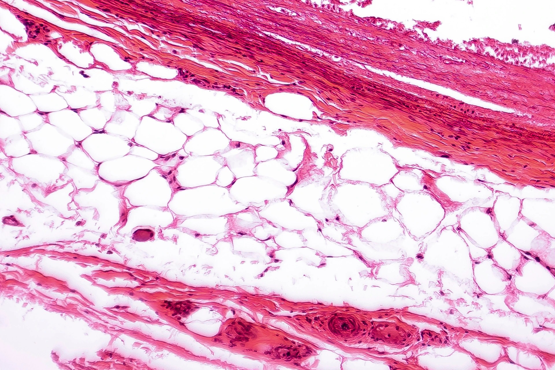 White adipose tissue