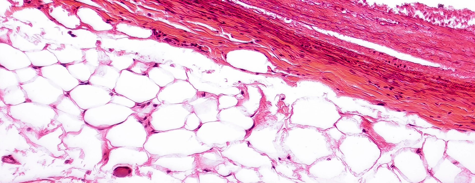 White adipose tissue