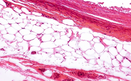 White adipose tissue