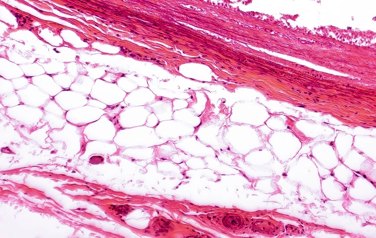 White adipose tissue