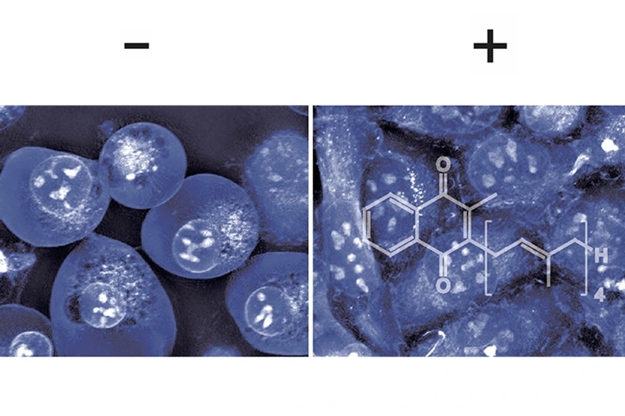 Vitamin K prevents cell death