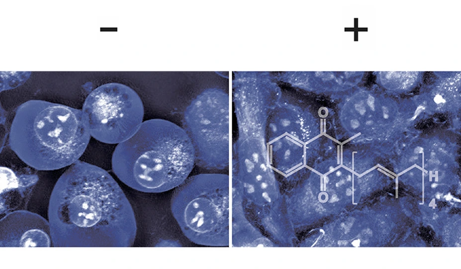 Vitamin K prevents cell death