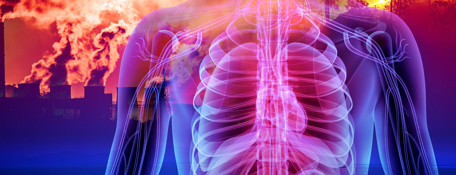 Institutsbild EPI - EHC Department