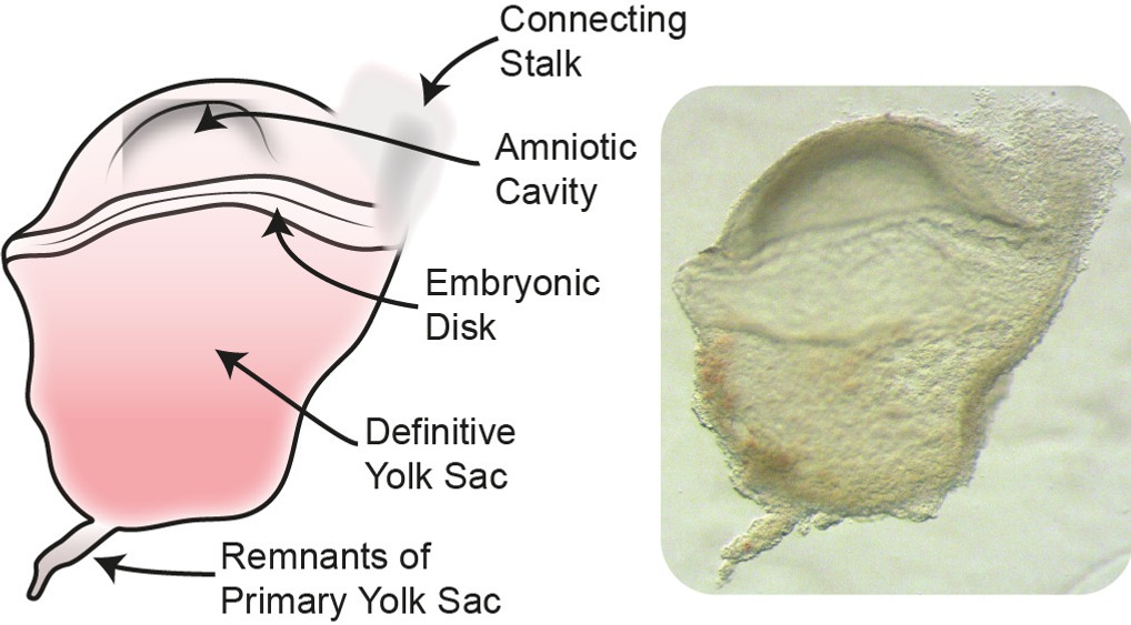 Graphical Illustration of a Human Gastrulation Embryo next to dissected Human Gastrulation Embryo

©The Author(s), under exclusive licence to Springer Nature Limited 2021