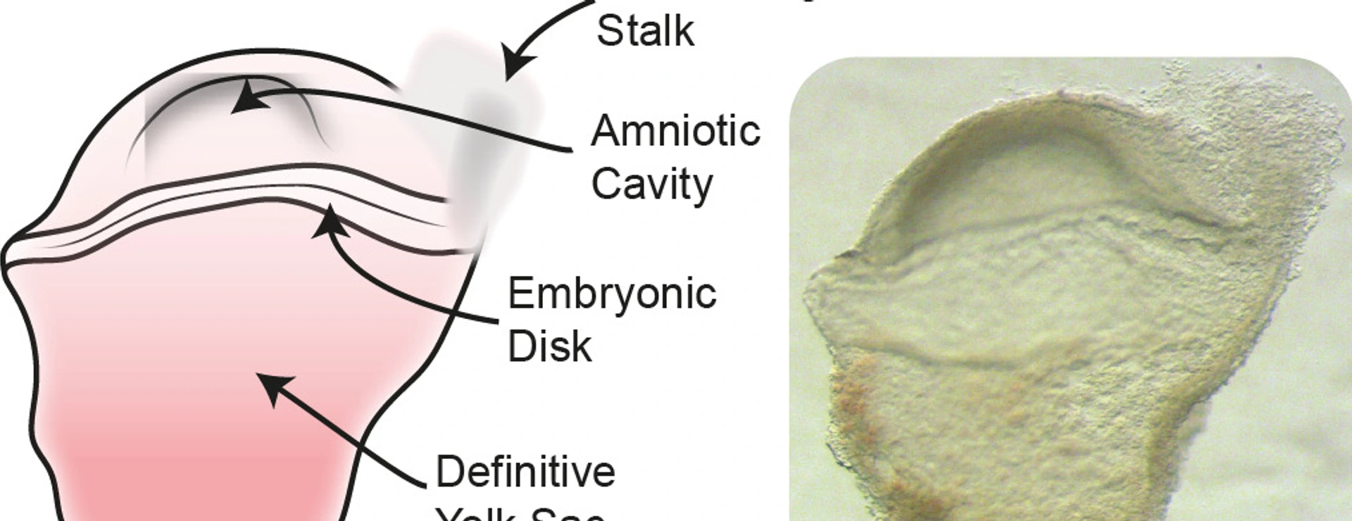 Human Gastrulation Embryo
