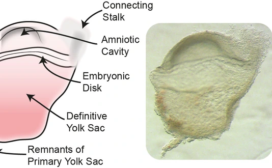 Human Gastrulation Embryo