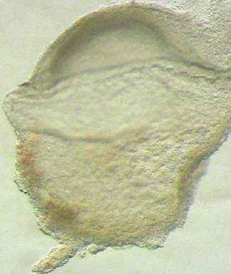 Human Gastrulation Embryo