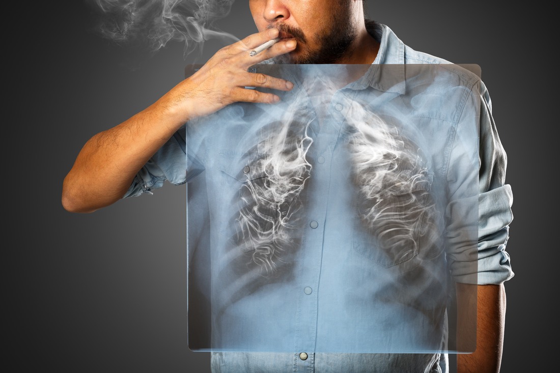Man smoking with x-ray lung, Isolated on grey background