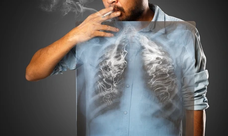 Man smoking with x-ray lung, Isolated on grey background