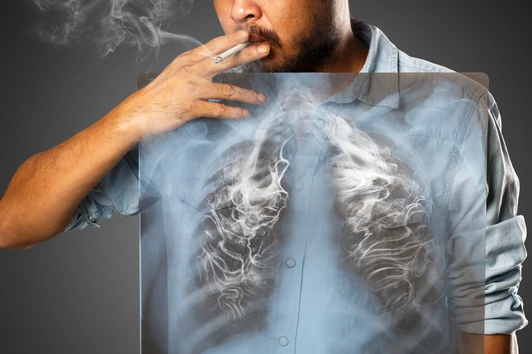 Man smoking with x-ray lung, Isolated on grey background