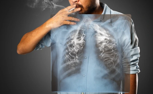 Man smoking with x-ray lung, Isolated on grey background