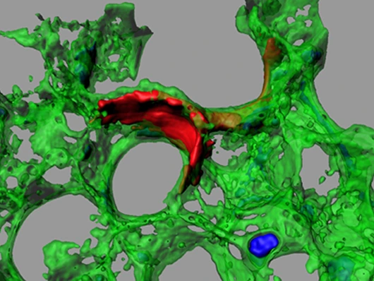 burgstaller_Decel_Lung_Fibroblasts_630x473px