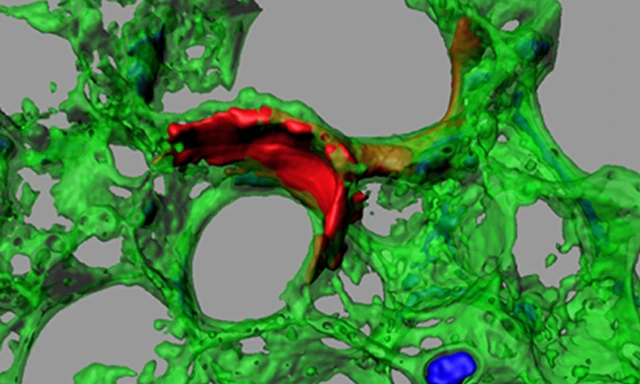 burgstaller_Decel_Lung_Fibroblasts_630x473px