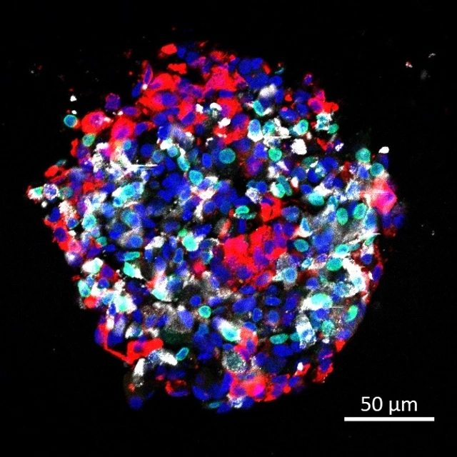 IDR Beta Cell Replacemnt Group_Setyono