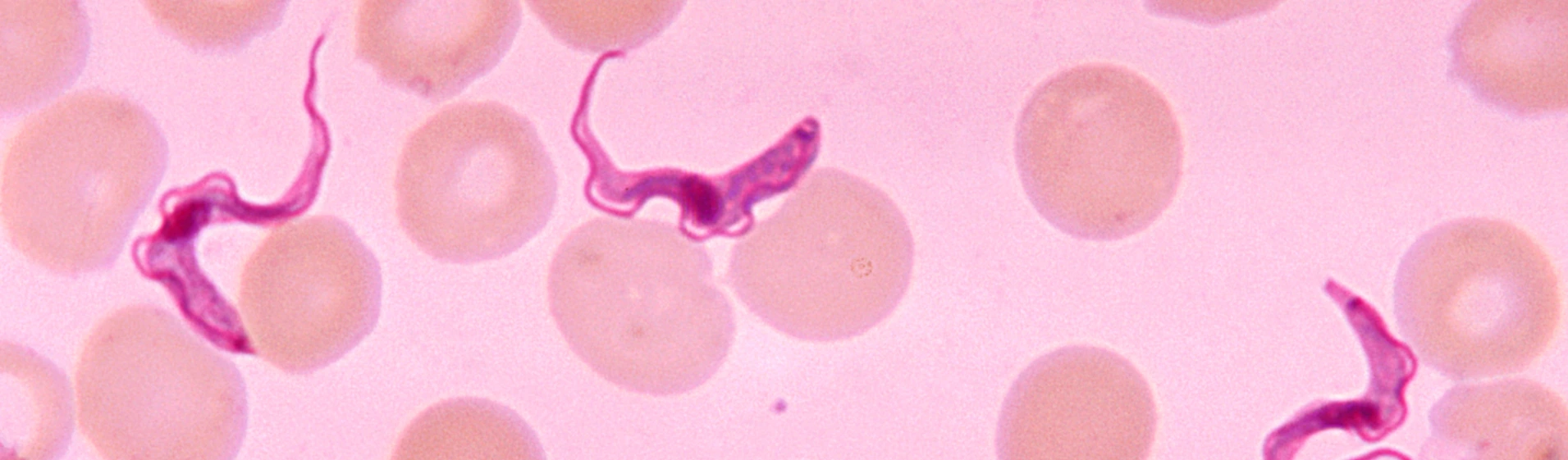 Trypanosoma