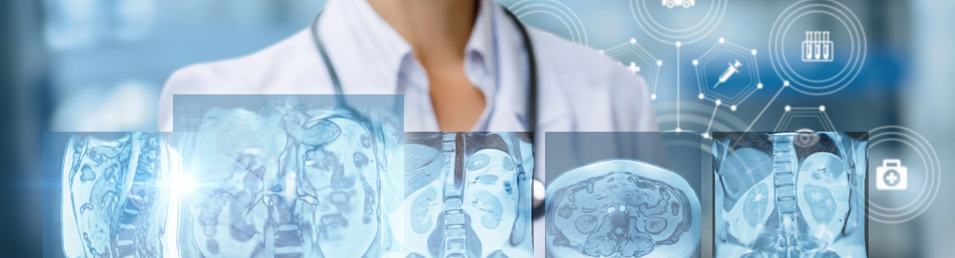Doctor examines of magnetic resonance imaging .
