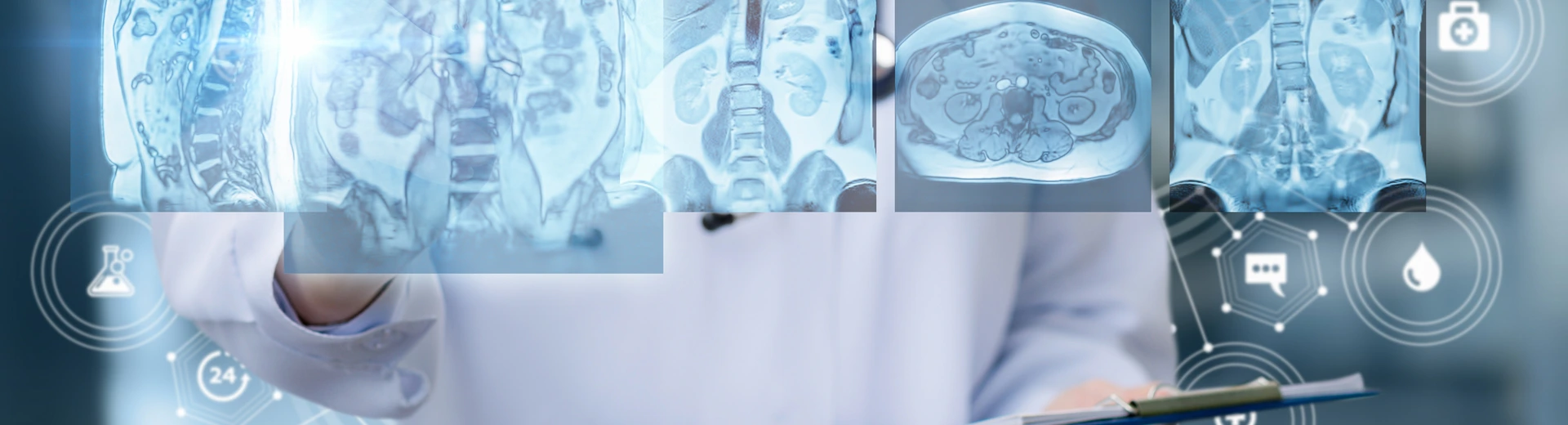 Doctor examines of magnetic resonance imaging .