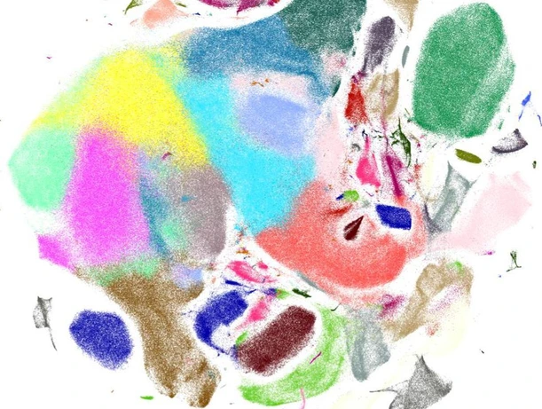 Scanpy - visual