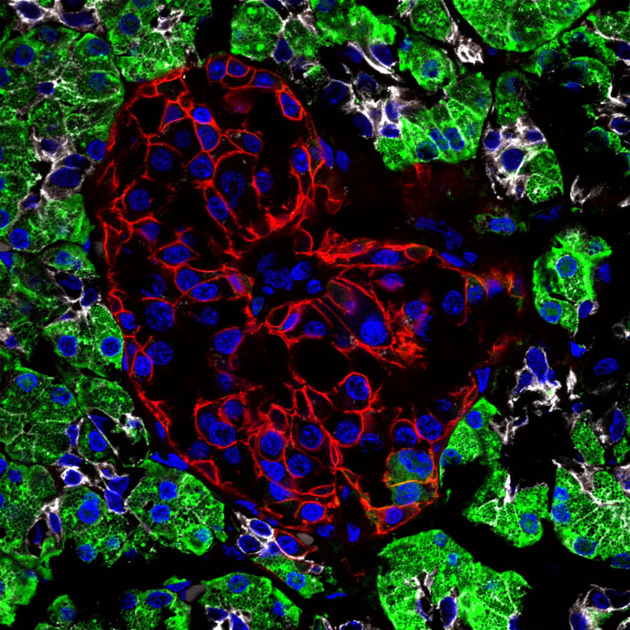 Healthy Islet of Langerhans_IDR