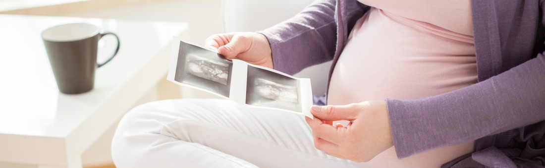 Schwangere Frau mit Ultraschallbildern